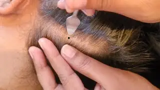 ASMR - Detailed Scalp Check, Hair Parting, Brushing, Scalp Picking & Scratching 🌿✨