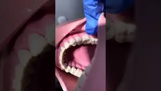 Dental diaries #vlog #dentalstudent #dentistry #dental #fail #univlog