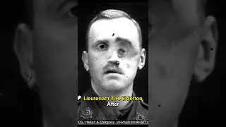 people before and after War #shorts #2023 #history #war #ww2 #pain #army #military #force #death