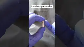 The Leadless pacemaker is an important new tool #heartblock #pacemaker #cardiachealth #cardiacnurse