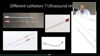 Evidence - Concencus on Technical aspects of Embryo Transfer Costas Panayotidis &Kappa;ώ&sigma;&tau;&alpha;&sigmaf; &Pi;&alpha;&nu;&alpha;&gamma;&iota;&omega;&tau;ί&delta;&eta;&sigmaf;