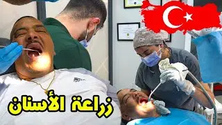 نيبا حيدو ليه سنانو مسكين🤪 او دارت ليه صوفيا طالوني 😵‍💫زراعة الأسنان