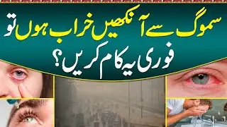 Smog Se Aankhon Me Jalan Ka ilaj -Smog Effects On Eyes & Prevention - How Affected Smog On Our Eyes?