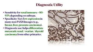 PAX 8  IHC #pathology #ihc #neet