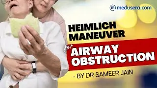 Heimlich maneuver for Airway Obstruction for #gnm #bscnursing #nursingstudent Part 26 Resp Medicine