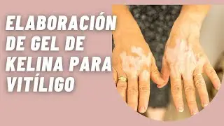 Elaboración de un Gel  Kelina Vitíligo