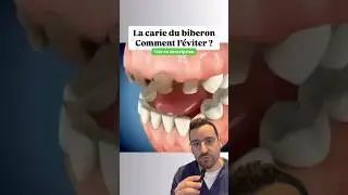 Carie du biberon : comment l&rsquo;&eacute;viter chez l&rsquo;enfant ? 🍼