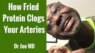 The Foods Assaulting & Clogging Up Your Arteries & More