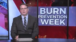 National Burn Awareness Week: Prevention Saves Lives