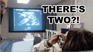 We didn't tell the Ultrasound tech there's TWINS!!