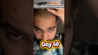 Natural hair growth day 60 #hairgrowth #naturalhairgrowth #haircare #shorts #short #hairtutorial