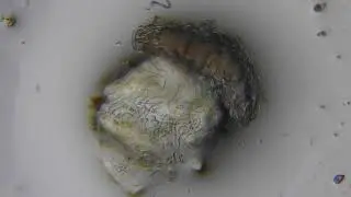 Tardigrade en cryptobiose