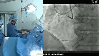 cto cd antero gaia3 finecross DR ROBIN