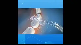 Cordless Water Flosser 200ml with 4 Replaceable Heads 11291 JETFLOSS EOKK