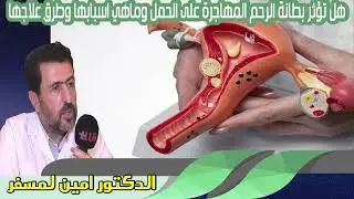 هل تؤثر بطانة الرحم المهاجرة على الحمل وماهي اسبابها وطرق علاجها الدكتور امين لمسفر
