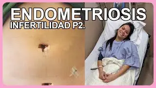 ENDOMETRIOSIS: MI HISTORIA CON UNA ENFERMEDAD SILENCIOSA, INFERTILIDAD Y CIRUGÍA.