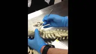 Atlanto occipitalligaementandmembrane