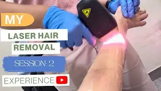 My 2nd Full body laser hair removal session || Full Experience