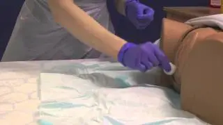 Female Catheterisation - Procedure Only