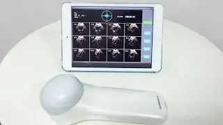 4D Wireless Probe Ultrasound Scanner MSLPU37 video