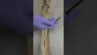 Ulnar nerve 