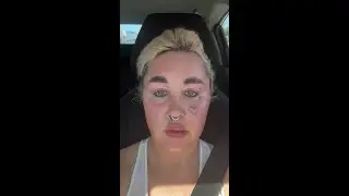 Amanda Bynes reveals new cosmetic procedure