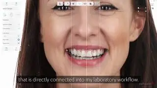 Make it easy for your patients with 3Shape Smile Design