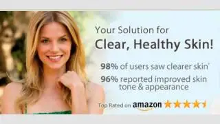 Exposed Skin Care review Exposed Skin Care Before & after Result