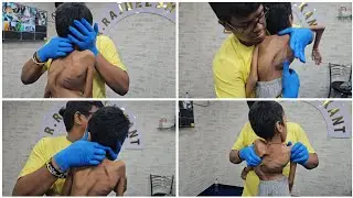 Scoliosis treatment by #drrajneeshkant