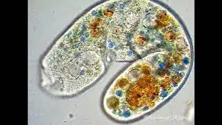 Nassulopsis - oral basket