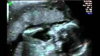 Echo baby Anneloes Bongers & Ralph Smit