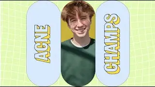 Peace Out | Acne Champs Testimonial #5: Devon