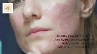 Glowing Skin Treatment for Instant Brightness and Deep Hydration