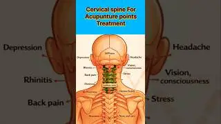 acupuncture points #cervicalpain#TherapistworldclubDoctor #Dr.opsingh_acupointsHajipur#youtubeshorts