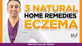 3 Natural Home Remedies [ECZEMA CURE?] MD Specialist Explains Atopic Dermatitis urdu