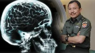 Terawan Agus Putranto - 7 Fakta Dokter yang Dipecat karena Metode Cuci Otak