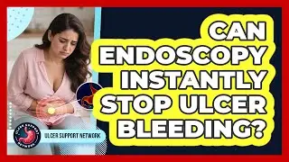 Can Endoscopy Instantly Stop Ulcer Bleeding? - Ulcer Support Network