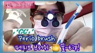 [치위생꿀Tip] GC - perio brush 사용 꿀팁!😉 - 치과위생사선생님들을 위한 영상이예요!💙