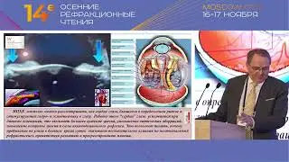 Патогенетические звенья постнатального рефрактогенезаразвития и прогрессирования миопии