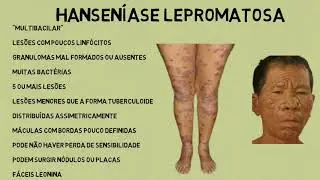 VIDEO HANSENIASE PPDC
