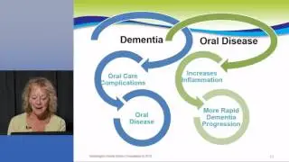 Oral Health and Chronic Disease