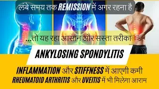 Ankylosing Spondylitis Effective Treatment Plan | HLA B 27 Treatment | CRP control |