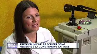Freedom Ink program offers free tattoo removal for ex-gang members, ex-convicts in Detroit