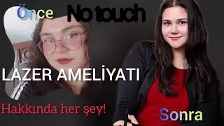NO TOUCH LAZER AMELİYATI HAKKINDA HER ŞEY/ İLK BİR AY NASIL GEÇİYOR?