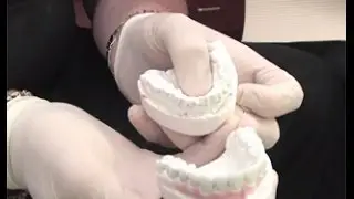 Patient First Philosophy with Cosmetic Dentist Dr. Guy M. Lewis