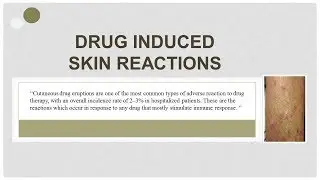 Drug induced skin reactions with types 🏥