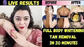 बरसो पुरानी ज़िद्दी TANNING हटाये रंग साफ़ करे| Full Body Whitening Formula- lighten Hands Legs Neck