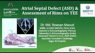 Atrial Septal Defect Size and Rims on Transesophageal Echocardiogram by Dr.Md  Rowsan Masud
