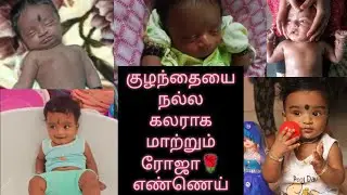 How I changed my baby colour /Baby colour increasing massage oil/ Rose Oil for Babies at home