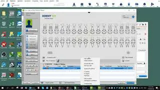 XDent - Quick Daily Workflow